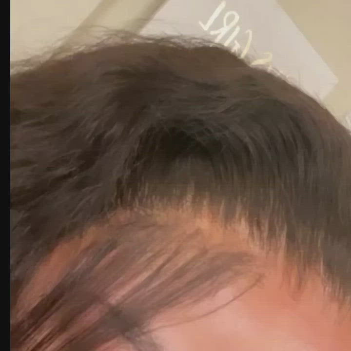HD Frontals